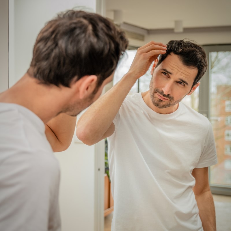 There are many causes of hair loss in males L1070139_-_Copy