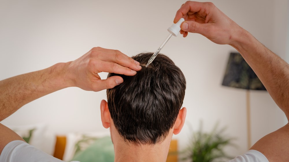 Treating Hair Loss with Minoxidil - Hair Guide