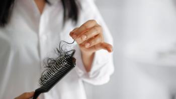 Hair Loss and Stress