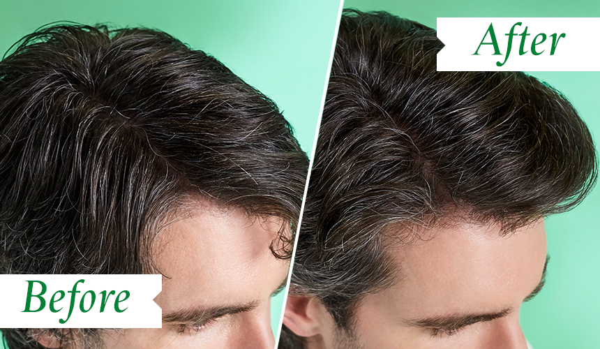 FAQ: Dandruff - Hair Guide